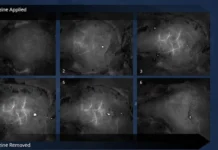 Alkooli Shkakton Ndryshime Masive në Tru – Studimi Tregon Pasoja Drastike Gehirnscan NMPH