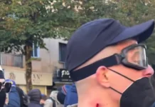 PLUMBAT E GOMËS NË PROTESTAT E TIRANËS: KU MBARON AUTORITETI POLICOR DHE KU FILLON CENIMI I TË DREJTAVE TË NJERIUT? Protestues me plumb gome në qafë