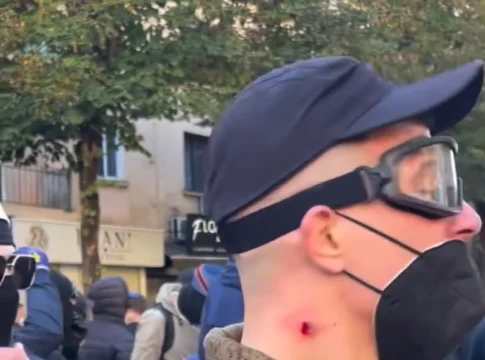 Protestues me plumb gome në qafë